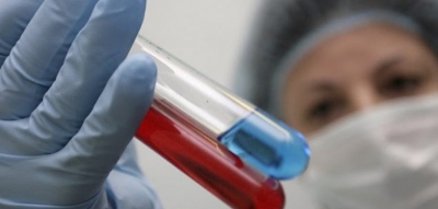 Testimi i fundit i vaksinës që parandalon SIDA-n