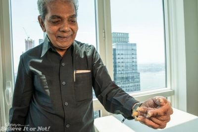Video/ Njeriu me thonjtë më të gjatë në botë pret thonjtë pas 66 vitesh