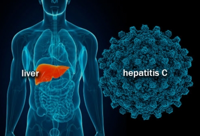 Hepatiti C, rrugët e transmetimit dhe parandalimi