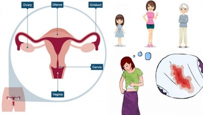 Faktorët që ndikojnë në vonimin e ciklit menstrual