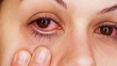 Tek syri fshihen sëmundjet: Sytë zbulojnë gjendjen e trupit tuaj