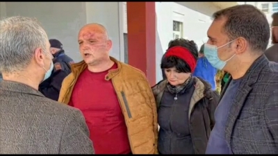 Fushatë për PD, sulmohet Dorian Protoduari, dëshmia: Ishin njerëzit e Arben Ahmetajt