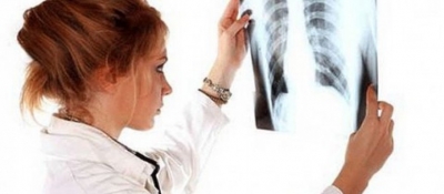 Alarmi/ Rikthehet tuberkulozi në Shqipëri, 440 raste të reja