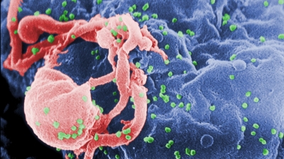 Zbulimi mahnitës që mund të çojë drejt kurimit të infeksionit HIV