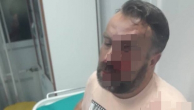 Dhunohet brutalisht gazetari, po hetonte vrasjen e Ivanoviç
