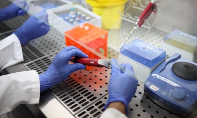 Ekspertja britanike: Mbajtja e dorezave si masë mbrojtje rrit rrezikun ndaj infektimit me koronavirus