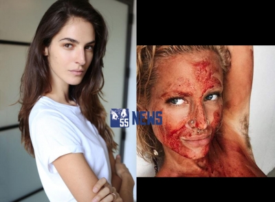 Emina Çunmulaj nxehet keq me foton nudo dhe të mbuluar me gjak të blogeres së njohur
