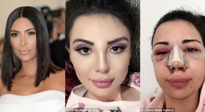 Modelja shpenzon mln dollarë për t’u dukur si Kim Kardashian, shiko transformimin