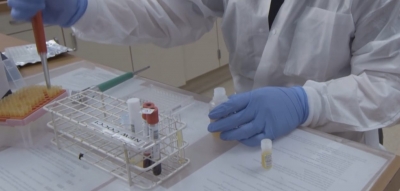 Analiza gjaku për orën biologjike