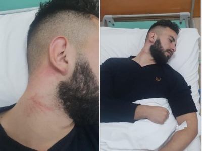 Ja gjendja e studentit ekselent të gazetarisë që u dhunua nga policia e Lleshajt
