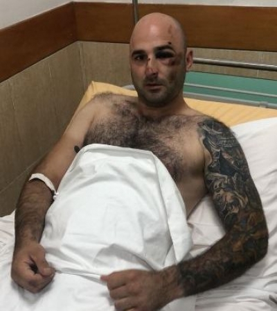 Video/ “Do t’ja q* m robt krejtve”, i plagosuri mik i ‘Stresit’. Përplasja me policinë në spital