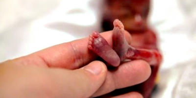 Çfarë ndodh pas abortit?