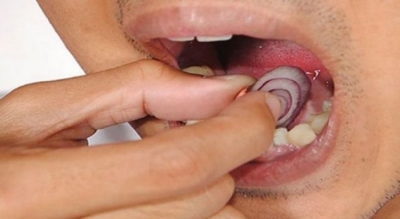 Keni dhimje dhëmbi? Si t’a kuroni pa shkuar tek dentisti...