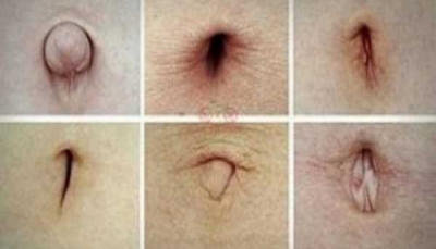 E pabesueshme, ja çfarë trego forma e kërthizës