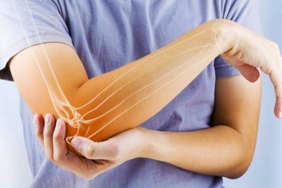 Osteoporoza – Si shmangen problemet jetësore të kockave