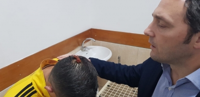 Bardh Spahia viziton në spital protestuesit e plagosur