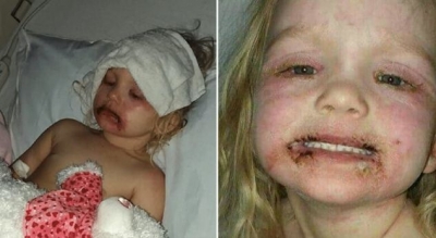 3-vjeçarja në gjendje të rëndë, pasi luajti me këtë lodër