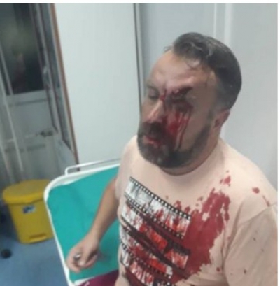 Zbulohet kush e dhunoi brutalisht gazetarin në Serbi